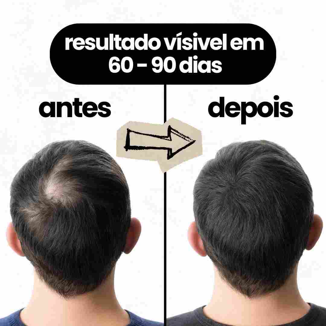 Sérum de crescimento capilar - alecrim, abacate e rícino